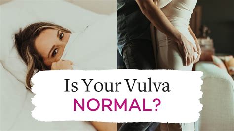 vulva pics|Normal Vulva